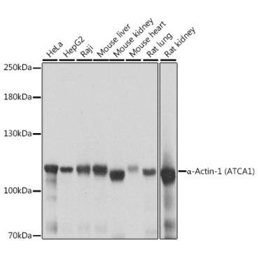 Alpha-Actinin-4 Rabbit Polyclonal Antibody