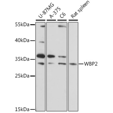 WBP2 Rabbit Polyclonal Antibody