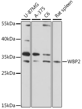 WBP2 Rabbit Polyclonal Antibody