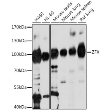ZFX Rabbit Polyclonal Antibody