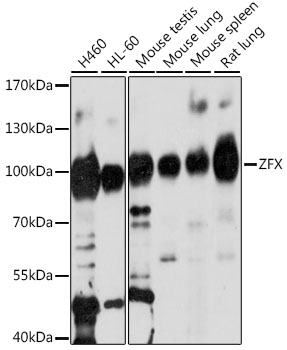 ZFX Rabbit Polyclonal Antibody