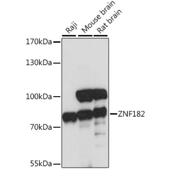 ZNF182 Rabbit Polyclonal Antibody