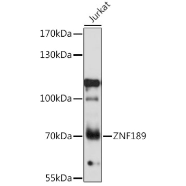 ZNF189 Rabbit Polyclonal Antibody