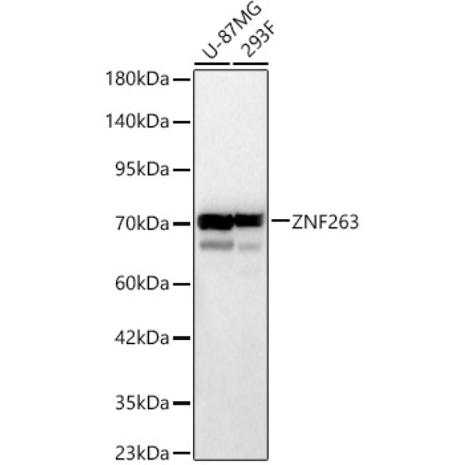 ZNF263 Rabbit Polyclonal Antibody