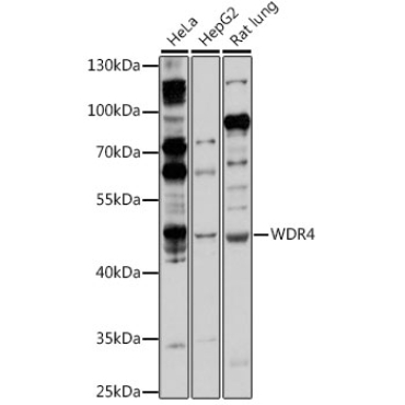 WDR4 Rabbit Polyclonal Antibody