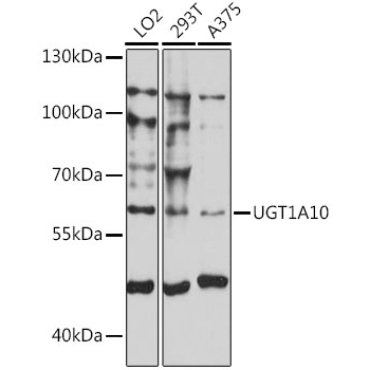 UGT1A10 Rabbit Polyclonal Antibody