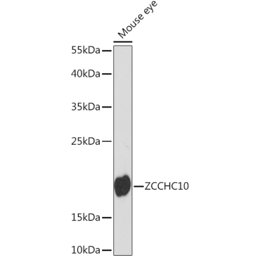 ZCCHC10 Rabbit Polyclonal Antibody