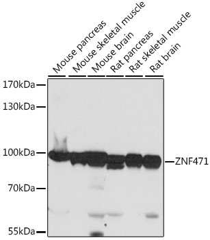 ZNF471 Rabbit Polyclonal Antibody