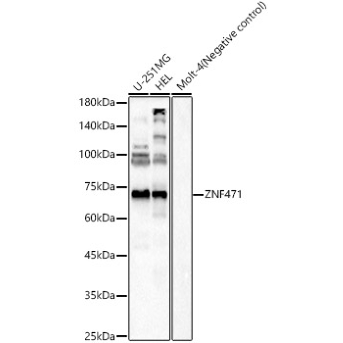 ZNF471 Rabbit Polyclonal Antibody