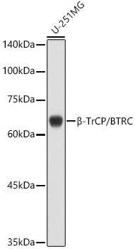 Beta-TrCP/BTRC Rabbit Polyclonal Antibody