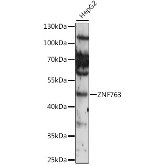 ZNF763 Rabbit Polyclonal Antibody