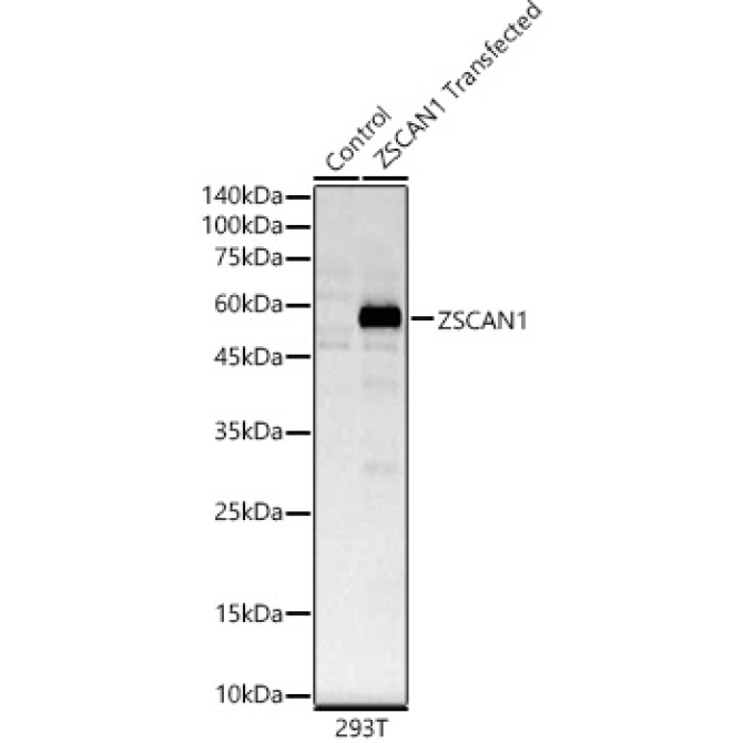 ZSCAN1 Rabbit Polyclonal Antibody