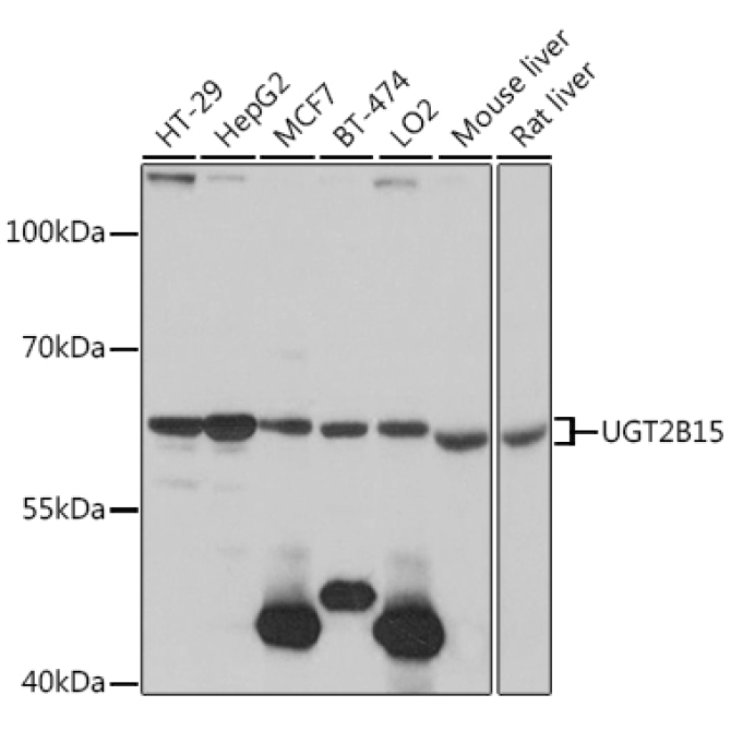 UGT2B15 Rabbit Polyclonal Antibody