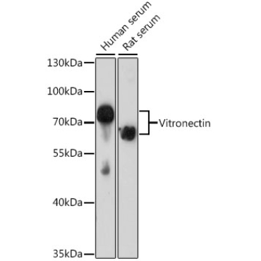 Vitronectin Rabbit Polyclonal Antibody