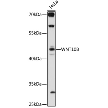 WNT10B Rabbit Polyclonal Antibody