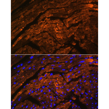 TTN Rabbit Polyclonal Antibody