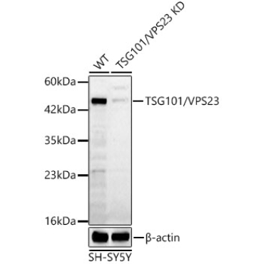 TSG101/VPS23 Rabbit Polyclonal Antibody