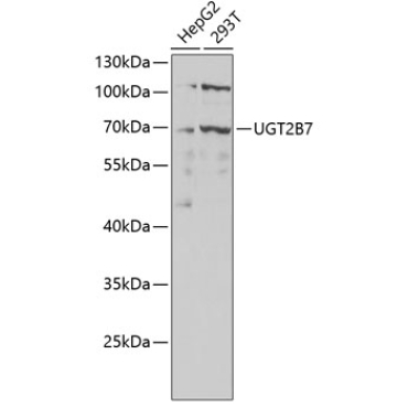 UGT2B7 Rabbit Polyclonal Antibody
