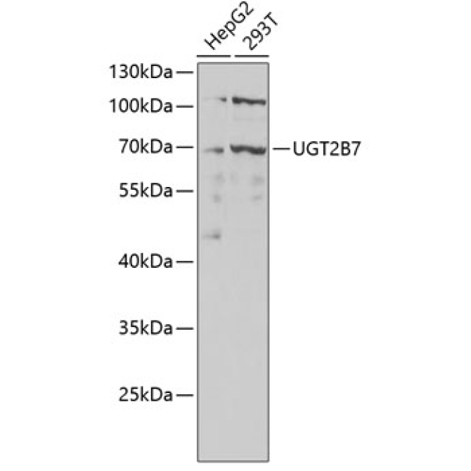 UGT2B7 Rabbit Polyclonal Antibody