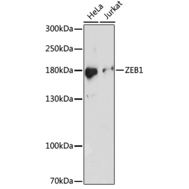 ZEB1 Rabbit Polyclonal Antibody