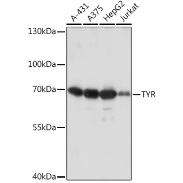 Tyrosinase Rabbit Polyclonal Antibody