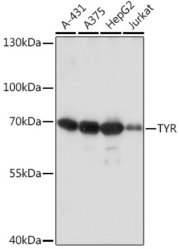 Tyrosinase Rabbit Polyclonal Antibody