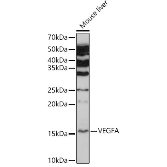 VEGFA Rabbit Polyclonal Antibody