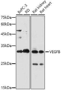 VEGFB Rabbit Polyclonal Antibody