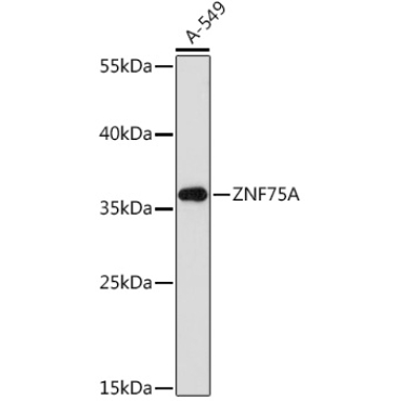 ZNF75A Rabbit Polyclonal Antibody