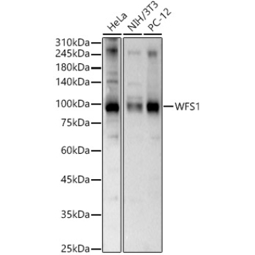 WFS1 Rabbit Polyclonal Antibody