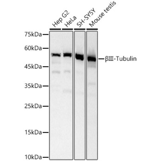 BetaIII-Tubulin Rabbit Polyclonal Antibody