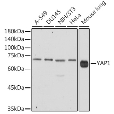 YAP1 Rabbit Polyclonal Antibody