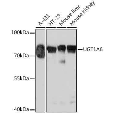 UGT1A6 Rabbit Polyclonal Antibody