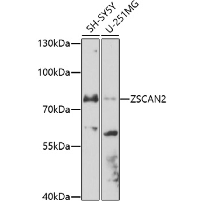 ZSCAN2 Rabbit Polyclonal Antibody