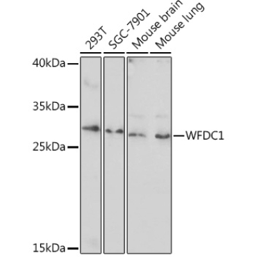 WFDC1 Rabbit Polyclonal Antibody