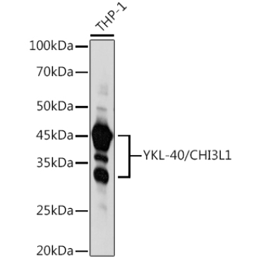 YKL-40/CHI3L1 Rabbit Polyclonal Antibody