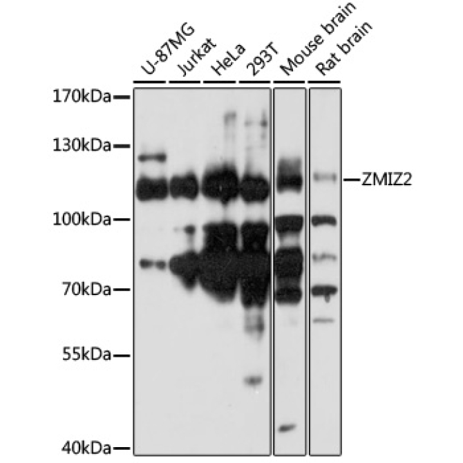 ZMIZ2 Rabbit Polyclonal Antibody