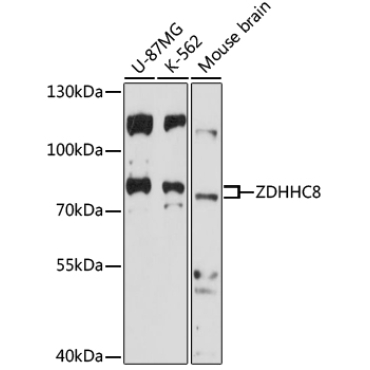 ZDHHC8 Rabbit Polyclonal Antibody