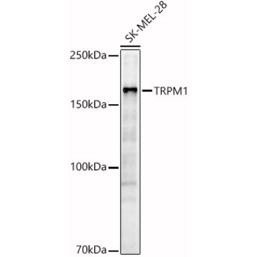 TRPM1 Rabbit Polyclonal Antibody