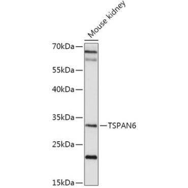 TSPAN6 Rabbit Polyclonal Antibody