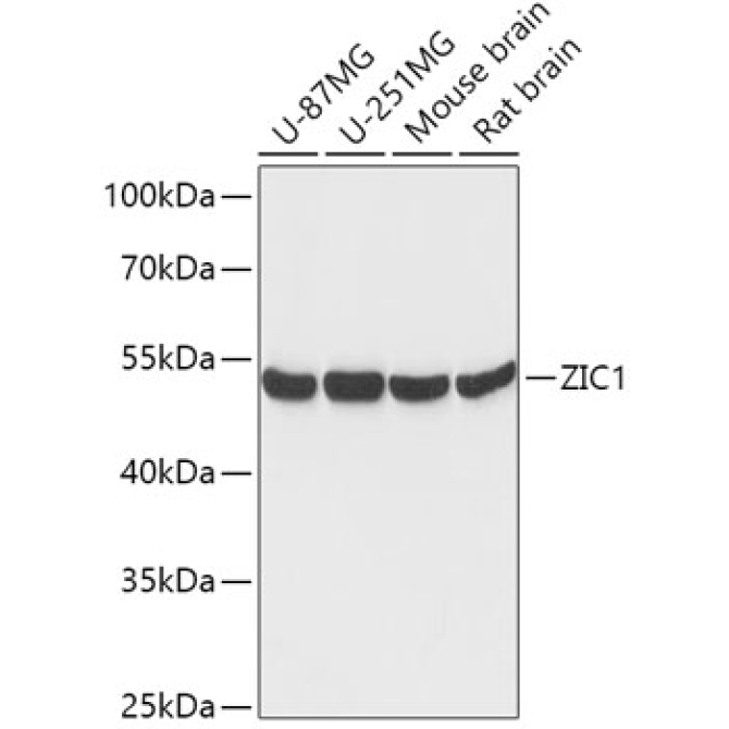 ZIC1 Rabbit Polyclonal Antibody