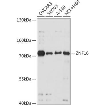 ZNF16 Rabbit Polyclonal Antibody