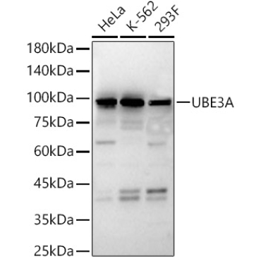 UBE3A Rabbit Polyclonal Antibody