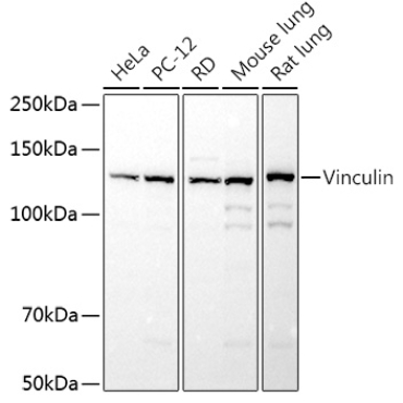 Vinculin Rabbit Polyclonal Antibody