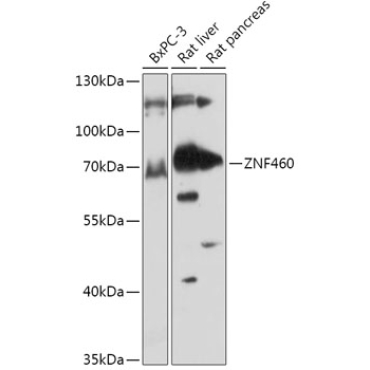 ZNF460 Rabbit Polyclonal Antibody