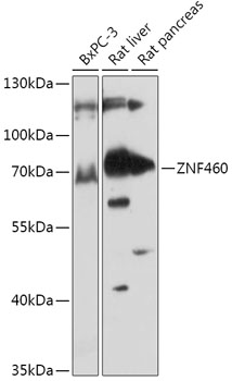 ZNF460 Rabbit Polyclonal Antibody