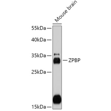 ZPBP Rabbit Polyclonal Antibody