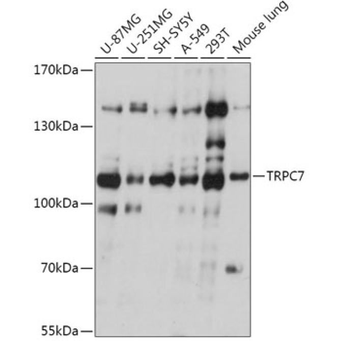 TRPC7 Rabbit Polyclonal Antibody