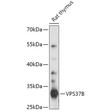 VPS37B Rabbit Polyclonal Antibody