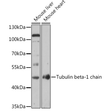 Tubulin beta-1 chain Rabbit Polyclonal Antibody